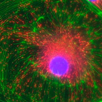 Filtres optiques pour l’imagerie à fluorescence